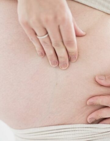 Frau streichelt und massiert Bauch gegen Dehnungsstreifen