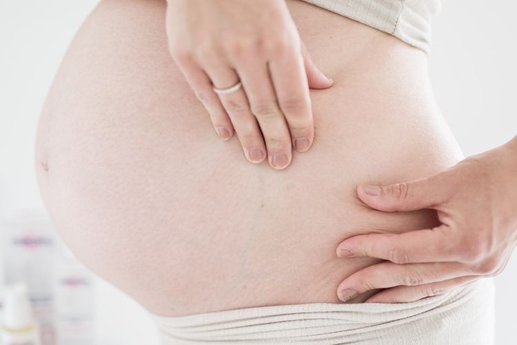 Frau streichelt und massiert Bauch gegen Dehnungsstreifen