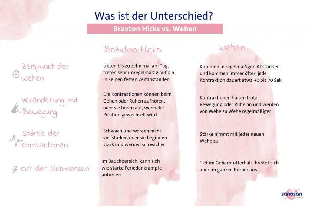 Infografik zur Unterscheidung von Braxton Hicks und Wehen