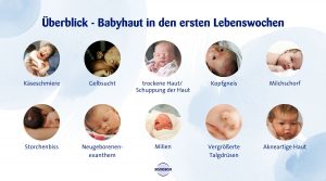 infografik zu babyhaut in den ersten lebenswochen