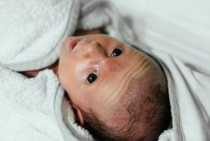baby-mit-kopfgneis