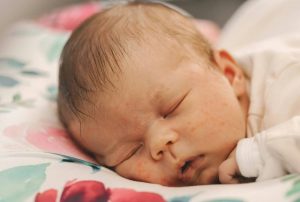 babyhaut mit roten flecken