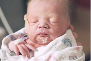 baby-mit-trockener-haut
